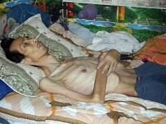 陈建中被接回时体重仅剩七十多斤，骨瘦如柴。