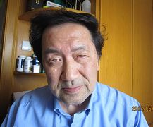 江振南遭受迫害后双目失明的照片